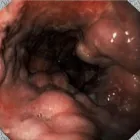 Afacere 2 imagine CMI DR BOSCORNEA TRAIAN CATALIN Sănătate şi Medicină în Ploieşti PH