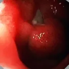 Afacere 3 imagine CMI DR BOSCORNEA TRAIAN CATALIN Sănătate şi Medicină în Ploieşti PH