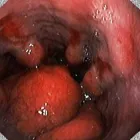 Afacere 4 imagine CMI DR BOSCORNEA TRAIAN CATALIN Sănătate şi Medicină în Ploieşti PH