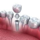 Afacere 12 imagine DENTIST DR. ARISTIDE DAN Stomatologi şi cabinete stomatologice în Bucureşti