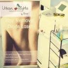 Afacere 1 imagine EPILARE DEFINITIVA LASER MEDICAL Servicii de epilare cu laser în Bucureşti