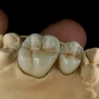 Afacere 1 imagine LABORATOR TEHNICA DENTARA HANGANU Stomatologi şi cabinete stomatologice în Ploieşti PH