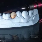 Afacere 4 imagine LABORATOR TEHNICA DENTARA HANGANU Stomatologi şi cabinete stomatologice în Ploieşti PH