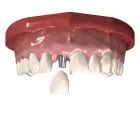 Afacere 1 imagine LABORATOR TEHNICA DENTARA STOMALUX Stomatologi şi cabinete stomatologice în Iaşi