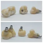 Afacere 11 imagine SC DENTAMIR SRL - LABORATOR DENTAR CAD CAM Stomatologi şi cabinete stomatologice în Oradea BH