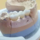 Afacere 15 imagine SC DENTAMIR SRL - LABORATOR DENTAR CAD CAM Stomatologi şi cabinete stomatologice în Oradea BH