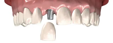 Afacere 1 imagine LABORATOR TEHNICA DENTARA STOMALUX Stomatologi şi cabinete stomatologice în Iaşi